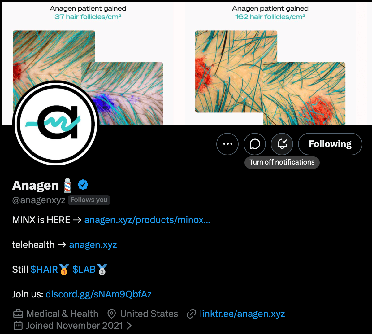 The @anagenxyz profile on X, with the notifications bell button highlighted.