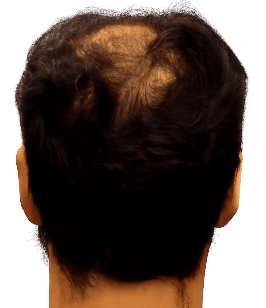 Before treatment